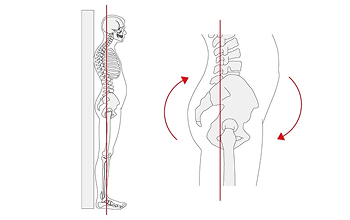 Anterior tilt - bekkenvinkel.png